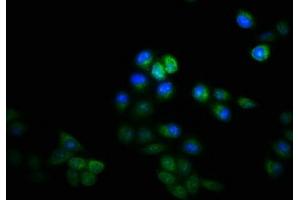 Immunofluorescence staining of Hela cells with ABIN7157464 at 1:133, counter-stained with DAPI. (KRT8 antibody  (AA 2-483))