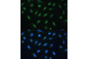 Immunofluorescence analysis of U-2 OS cells using  antibody (ABIN6127378, ABIN6137233, ABIN6137235 and ABIN6217480) at dilution of 1:100. (ATF3 antibody  (AA 1-181))