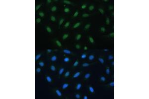 Immunofluorescence analysis of U-2 OS cells using  antibody (ABIN6127378, ABIN6137233, ABIN6137235 and ABIN6217480) at dilution of 1:100. (ATF3 antibody  (AA 1-181))