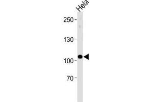 Western Blotting (WB) image for anti-Ubiquitin Protein Ligase E3C (UBE3C) antibody (ABIN3004610)