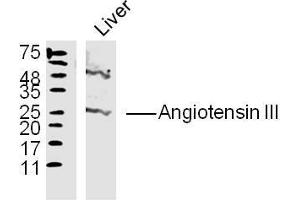 Liver lysates probed with Angiotensin III Polyclonal Antibody, Unconjugated  at 1:300 overnight at 4˚C. (Angiotensin III antibody  (AA 35-41))