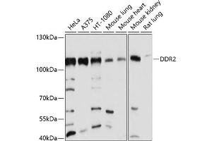 Western blot analysis of extracts of various cell lines, using DDR2 antibody (ABIN6130247, ABIN6139473, ABIN6139474 and ABIN6214178) at 1:1000 dilution.
