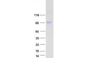 Western Blotting (WB) image for Amiloride-Sensitive Cation Channel 2, Neuronal (ACCN2) (Transcript Variant 2) protein (Myc-DYKDDDDK Tag) (ABIN2714985)