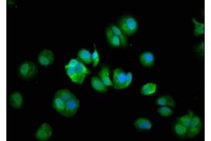 Immunofluorescence staining of MCF-7 cells with ABIN7148018 at 1:133, counter-stained with DAPI. (COPG2 antibody  (AA 676-823))