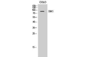 Western Blotting (WB) image for anti-Salt-Inducible Kinase 1 (SIK1) (Tyr86) antibody (ABIN3186959)
