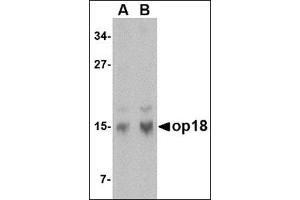 Western blot analysis of op18 in human brain tissue lysate with this product at (A) 0.