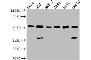 Western Blot Positive WB detected in: Hela whole cell lysate, 293 whole cell lysate, MCF-7 whole cell lysate, A549 whole cell lysate, Raji whole cell lysate, HepG2 whole cell lysate All lanes: SMAD1 antibody at 3 μg/mL Secondary Goat polyclonal to rabbit IgG at 1/50000 dilution Predicted band size: 53, 16 kDa Observed band size: 53 kDa (SMAD1 antibody  (AA 202-335))