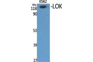 Western Blot (WB) analysis of specific cells using LOK Polyclonal Antibody. (STK10-A antibody  (Internal Region))