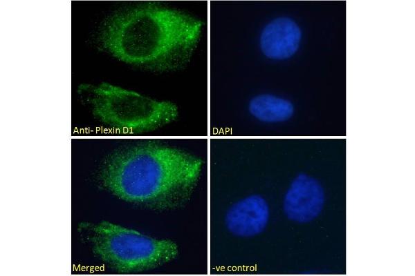 PLXND1 antibody  (Internal Region)