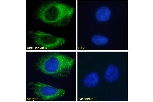 ABIN185358 Immunofluorescence analysis of paraformaldehyde fixed HeLa cells, permeabilized with 0. (PLXND1 antibody  (Internal Region))