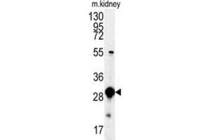 Western Blotting (WB) image for anti-Mercaptopyruvate Sulfurtransferase (MPST) antibody (ABIN3003390) (MPST antibody)
