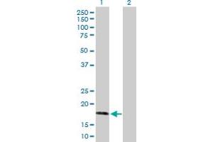 Western Blot analysis of AHNAK expression in transfected 293T cell line by AHNAK MaxPab polyclonal antibody.