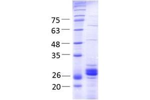 SDS-PAGE (SDS) image for THO Complex 4 (THOC4) (AA 2-257) protein (His tag,Strep Tag) (ABIN3095871)