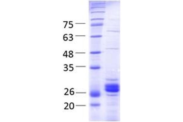 THO Complex 4 Protein (THOC4) (AA 2-257) (His tag,Strep Tag)
