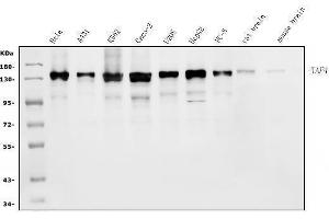 Western blot analysis of TAF4 using anti-TAF4 antibody (ABIN7602114).