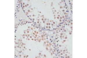 Immunohistochemistry of paraffin-embedded rat testis using Phospho-RPS6K-S376 antibody (ABIN7270039) at dilution of 1:100 (40x lens). (MSK1 antibody  (pSer376))