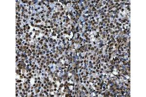 IHC analysis of TIP49A/RUVBL1 using anti-TIP49A/RUVBL1 antibody (ABIN7599928).