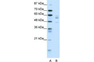 WB Suggested Anti-PAX6 Antibody Titration:  0. (PAX6 antibody  (N-Term))