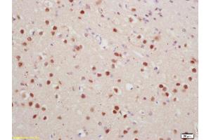 Formalin-fixed and paraffin embedded rat brain labeled with Anti-phospho-Histone H1. (HIST1H1E antibody  (pThr18))
