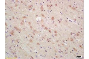 Formalin-fixed and paraffin embedded rat brain labeled with Rabbit Anti ARP3 Polyclonal Antibody, Unconjugated (ABIN1387419) at 1:200 followed by conjugation to the secondary antibody and DAB staining (ANGPTL6 antibody  (AA 301-400))