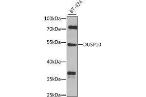 Western blot analysis of extracts of BT-474 cells, using DUSP10 antibody (ABIN6127786, ABIN6139859, ABIN6139860 and ABIN6224777) at 1:1000 dilution. (DUSP10 antibody  (AA 1-300))