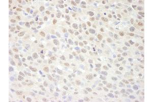 anti-Suppressor of Ty 6 Homolog (SUPT6H) (AA 425-475) antibody