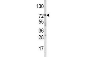 Western blot analysis of ABCG1 antibody and mouse spleen tissue lysate.
