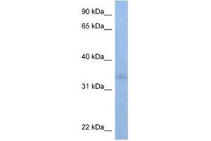 ST6GALNAC3 antibody used at 1 ug/ml to detect target protein. (alpha-N-Acetylgalactosaminide alpha-2,6-Sialyltransferase 3 (SIA7C) (C-Term) antibody)