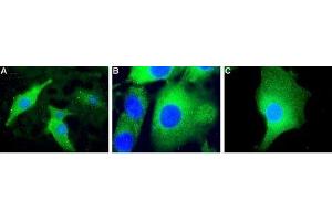 Expression of Mitochondrial uncoupling protein 2 (UCP2) in mouse C2C12 cells. (UCP2 antibody  (Intracellular))