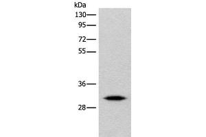 Western blot analysis of Human cerebrum tissue lysate using IMPA1 Polyclonal Antibody at dilution of 1:360 (IMPA1 antibody)