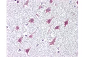 Anti-ZMYM3 antibody IHC of human brain, cortex. (ZMYM3 antibody  (C-Term))