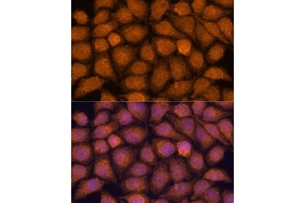 TNFAIP8L2 antibody  (AA 1-184)