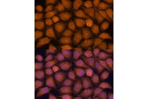 Immunofluorescence analysis of HeLa cells using TNFL2 antibody (ABIN6133093, ABIN6149298, ABIN6149299 and ABIN6217788) at dilution of 1:100. (TNFAIP8L2 antibody  (AA 1-184))