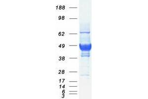 Western Blotting (WB) image for Basigin (Ok Blood Group) (BSG) (Transcript Variant 1) protein (Myc-DYKDDDDK Tag) (ABIN2713431)
