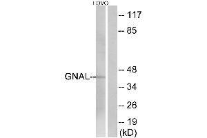 Immunohistochemistry analysis of paraffin-embedded human brain tissue using GNAL antibody.