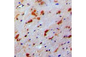 Immunohistochemical analysis of PDRG1 staining in human brain formalin fixed paraffin embedded tissue section. (PDRG1 antibody  (Center))
