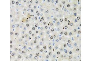 Immunohistochemistry of paraffin-embedded Rat liver using CDK6 Polyclonal Antibody at dilution of 1:100 (40x lens).