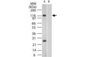 Western blot analysis of SIK2 in human brain in the A) absence and B) presence of immunizing peptide, using SIK2 polyclonal antibody  at 2 ug/mL . (SIK2 antibody  (AA 100-150))