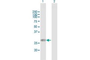 Western Blot analysis of TPD52L2 expression in transfected 293T cell line by TPD52L2 MaxPab polyclonal antibody. (TPD52L2 antibody  (AA 1-206))