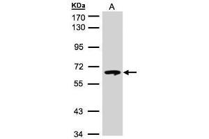 WB Image Sample(30 μg of whole cell lysate) A:Hep G2, 7. (GBA antibody  (C-Term))