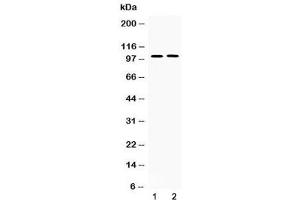 Western blot testing of 1) rat lung and 2) human PANC1 lysate with PDE5A antibody at 0. (PDE5A antibody  (AA 20-63))