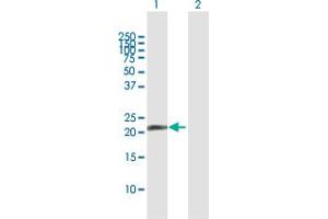 Western Blot analysis of PDE4DIP expression in transfected 293T cell line by PDE4DIP MaxPab polyclonal antibody. (PDE4DIP antibody  (AA 1-177))