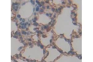 Used in DAB staining on fromalin fixed paraffin- embedded Kidney tissue (NOTCH4 antibody  (AA 1690-1945))