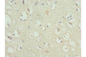 Immunohistochemistry of paraffin-embedded human brain tissue using ABIN7157743 at dilution of 1:100 (KCNIP2 antibody  (AA 1-90))