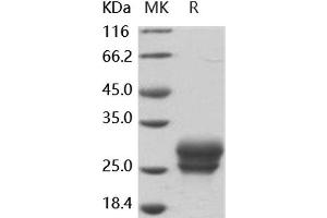 FZD4 Protein (His tag)