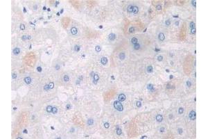 IHC-P analysis of Human Liver Tissue, with DAB staining. (APPL1 antibody  (AA 404-673))