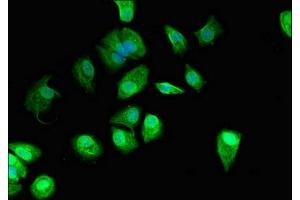 Immunofluorescent analysis of MCF-7 cells using ABIN7165618 at dilution of 1:100 and Alexa Fluor 488-congugated AffiniPure Goat Anti-Rabbit IgG(H+L) (C22orf13 antibody  (AA 1-136))