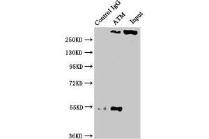 Immunoprecipitating ATM in PC3 whole cell lysate Lane 1: Rabbit control IgG instead of ABIN7127350 in PC3 whole cell lysate. (Recombinant ATM antibody)
