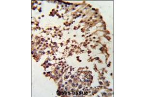 Formalin-fixed and paraffin-embedded human testis tissue reacted with RB1 Antibody , which was peroxidase-conjugated to the secondary antibody, followed by DAB staining. (Retinoblastoma 1 antibody  (C-Term))