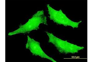 Immunofluorescence of monoclonal antibody to SENP7 on HeLa cell. (SENP7 antibody  (AA 1-110))